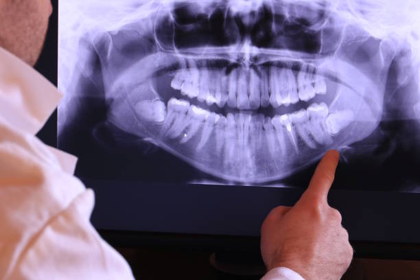 Best Holiday Emergency Dentist in Mayville, ND