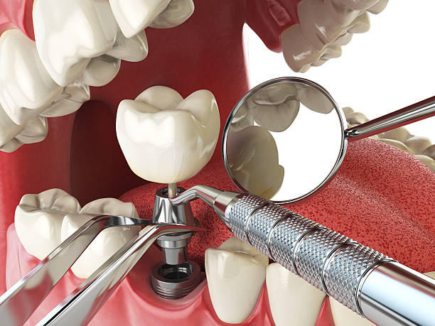 Best Emergency Dentist for Knocked-Out Tooth in Mayville, ND